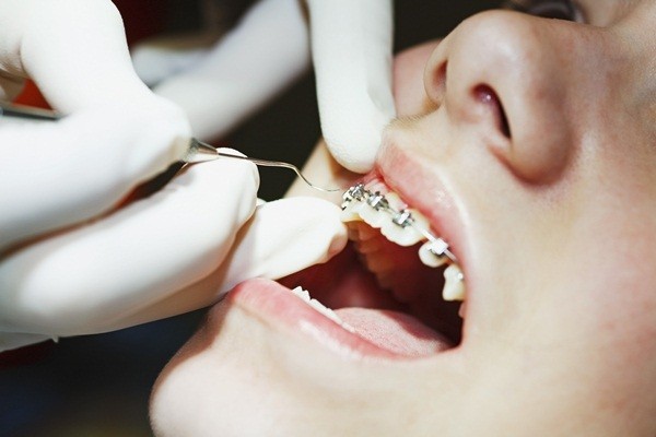 การรับจัดฟันใน อาชีพทันตแพทย์ รายได้ดี